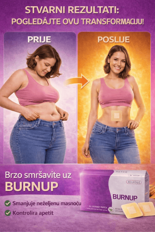 BURNUP IMG7