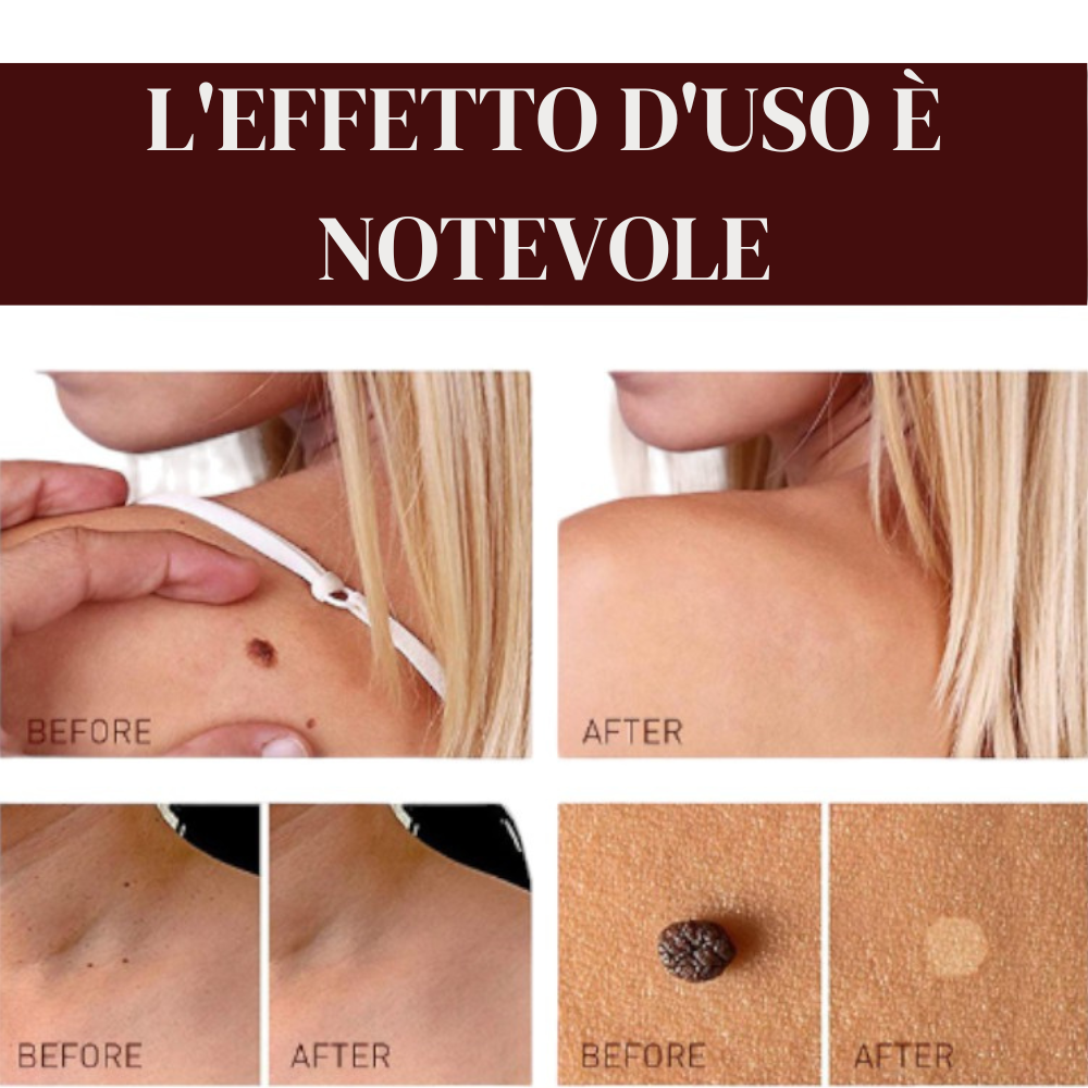 Aggiungi-un-titolo-1-1.png