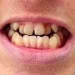 snap-on-smile-5.jpg